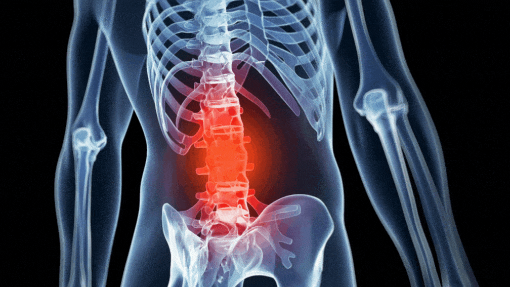 Spine Compression Illustration